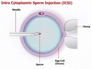 Intra cytoplasmic Sperm Injection
