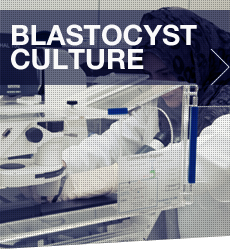 blastocyst_culture